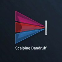 Scalping Dandruff